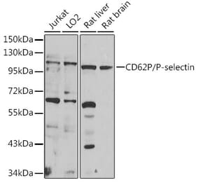 Western Blot - Anti-P-Selectin Antibody (A16815) - Antibodies.com