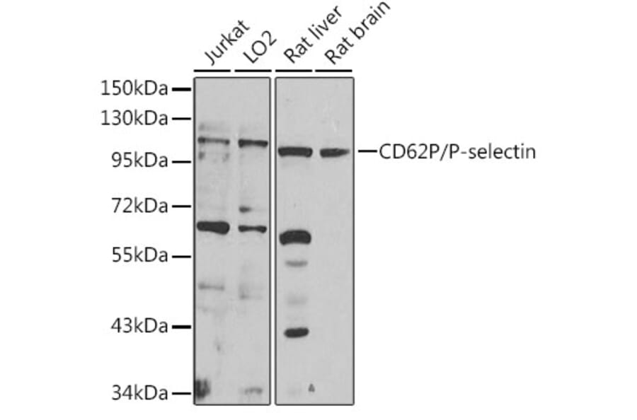 Western Blot - Anti-P-Selectin Antibody (A16815) - Antibodies.com