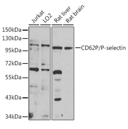 Western Blot - Anti-P-Selectin Antibody (A16815) - Antibodies.com
