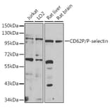 Western Blot - Anti-P-Selectin Antibody (A16815) - Antibodies.com