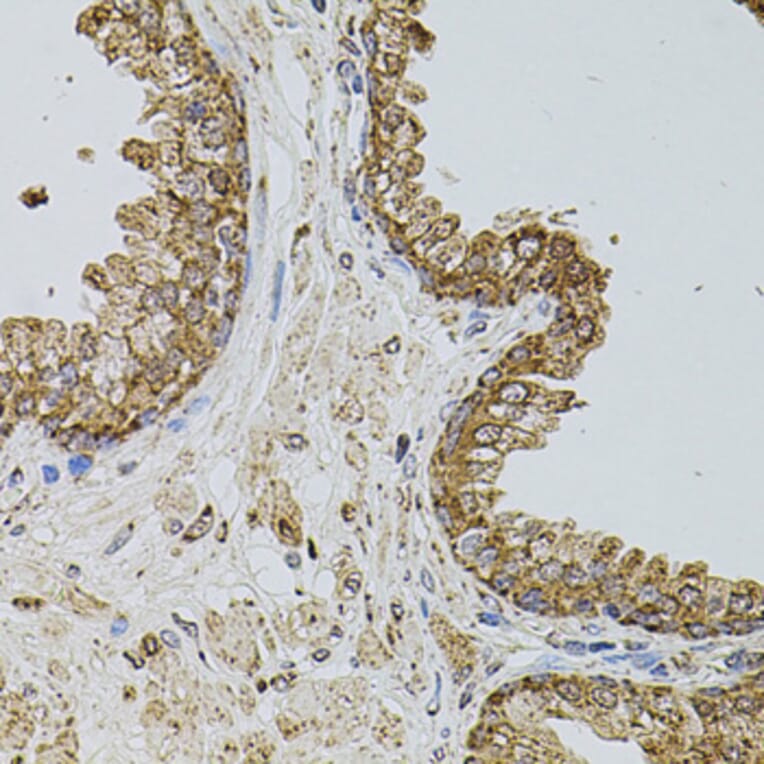 Immunohistochemistry - Anti-P-Selectin Antibody (A16815) - Antibodies.com