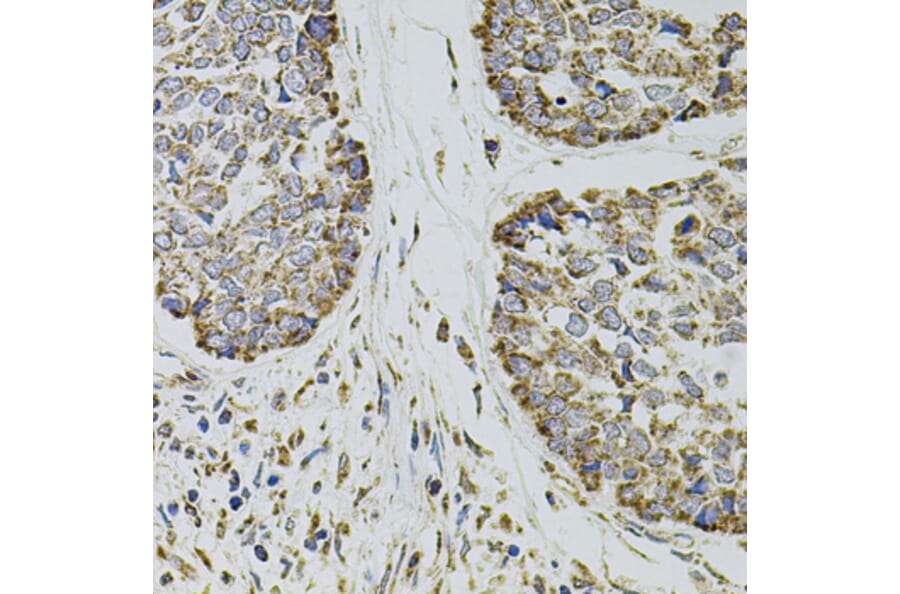 Immunohistochemistry - Anti-P-Selectin Antibody (A16815) - Antibodies.com