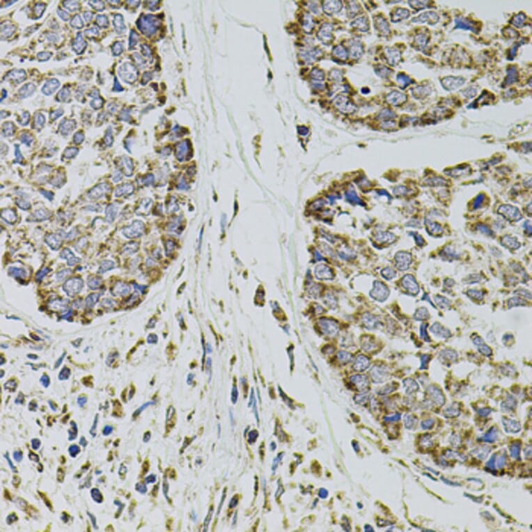 Immunohistochemistry - Anti-P-Selectin Antibody (A16815) - Antibodies.com
