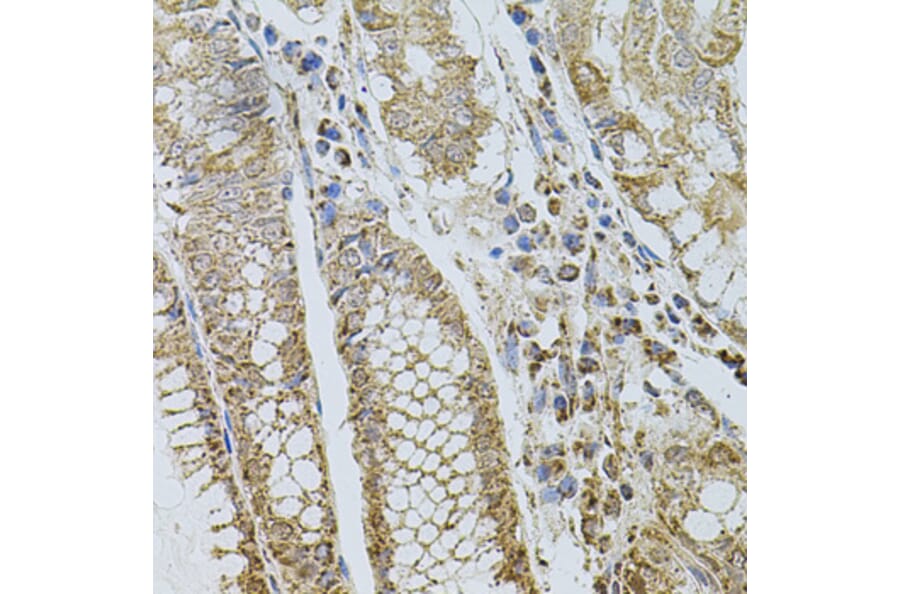 Immunohistochemistry - Anti-P-Selectin Antibody (A16815) - Antibodies.com
