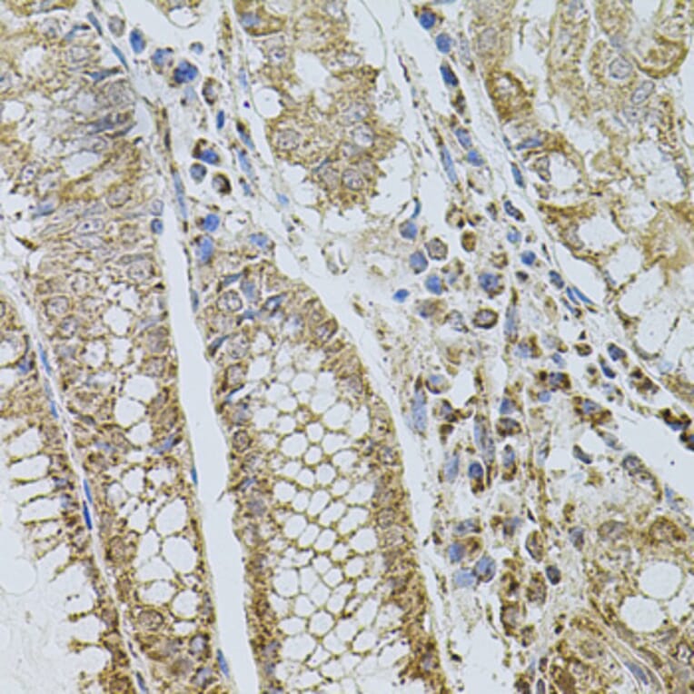 Immunohistochemistry - Anti-P-Selectin Antibody (A16815) - Antibodies.com