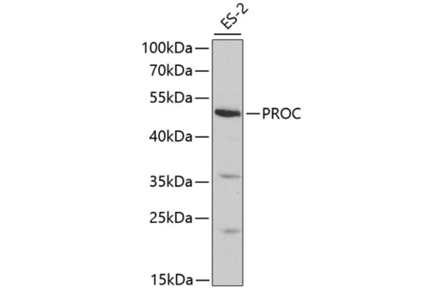 Western Blot - Anti-PROC Antibody (A1432) - Antibodies.com