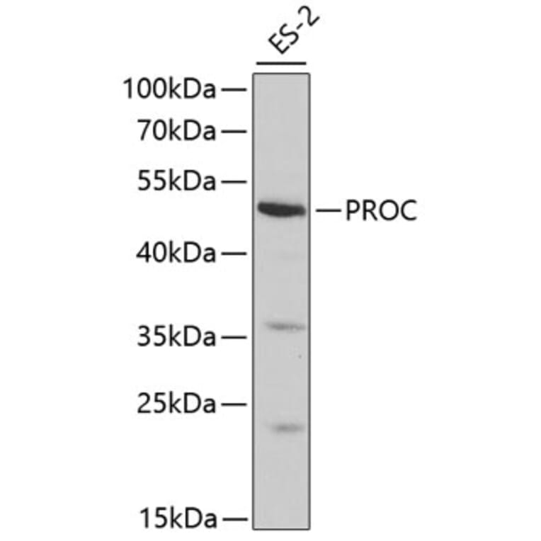 Western Blot - Anti-PROC Antibody (A1432) - Antibodies.com