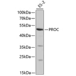 Western Blot - Anti-PROC Antibody (A1432) - Antibodies.com