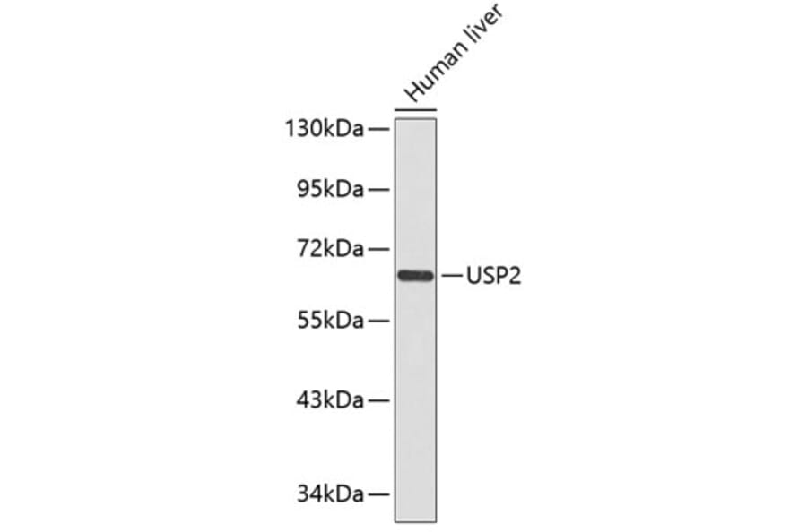 Western Blot - Anti-USP2 Antibody (A1433) - Antibodies.com