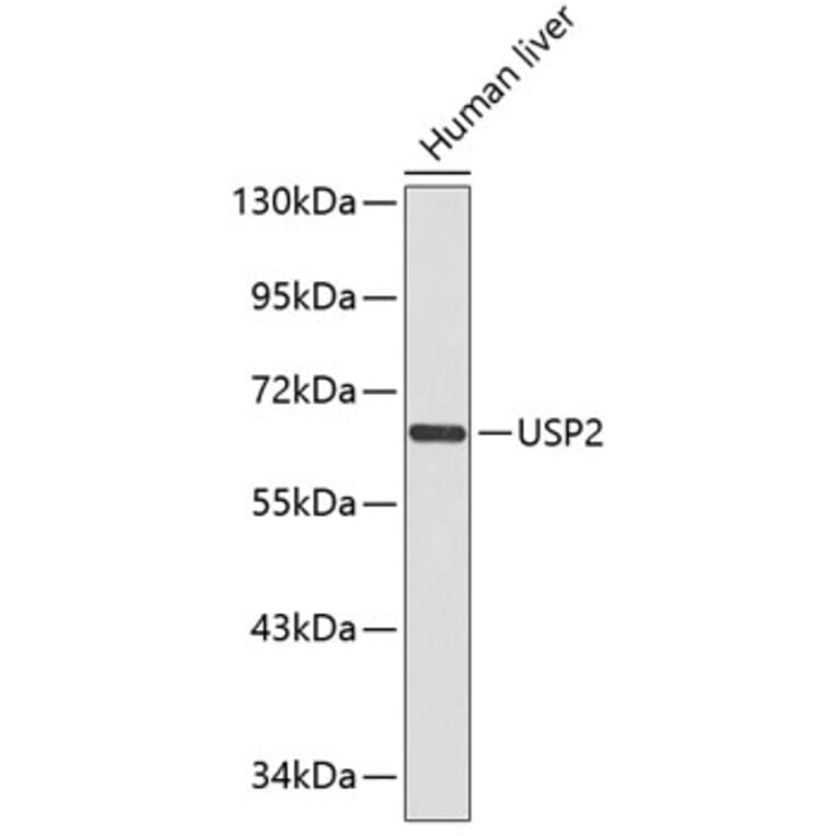 Western Blot - Anti-USP2 Antibody (A1433) - Antibodies.com