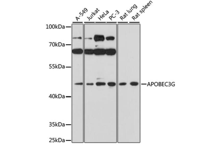 Western Blot - Anti-APOBEC3G/A3G Antibody (A16818) - Antibodies.com