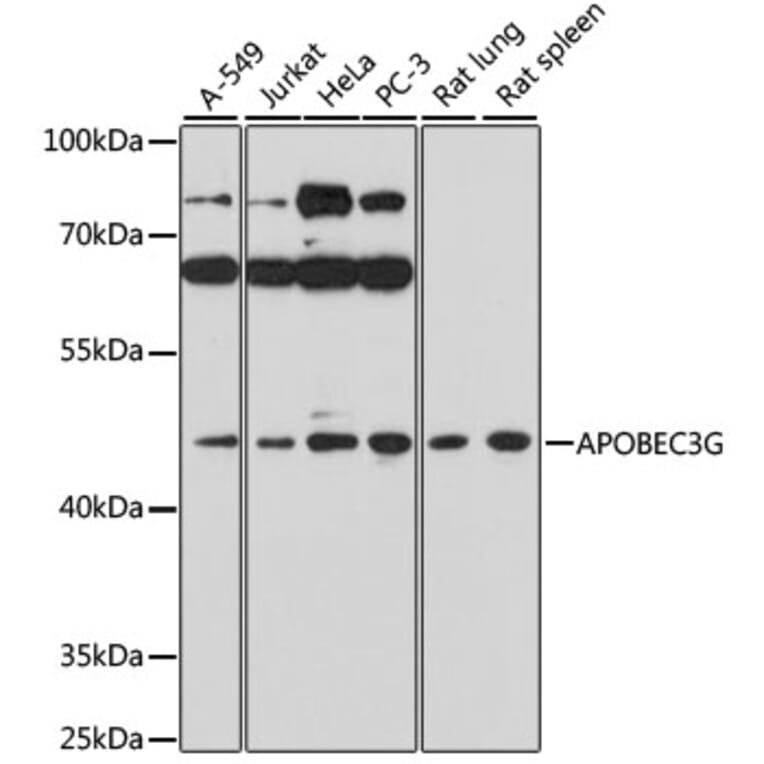 Western Blot - Anti-APOBEC3G/A3G Antibody (A16818) - Antibodies.com