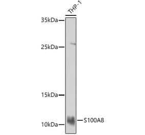 Western Blot - Anti-MRP8 Antibody (A16819) - Antibodies.com
