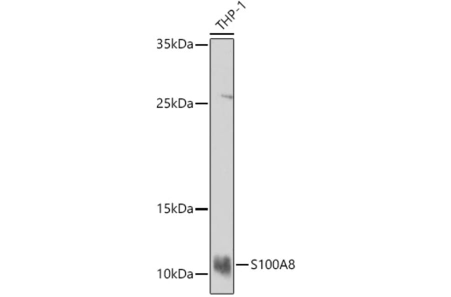 Western Blot - Anti-MRP8 Antibody (A16819) - Antibodies.com