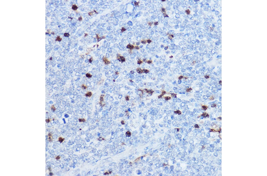 Immunohistochemistry - Anti-MRP8 Antibody (A16819) - Antibodies.com