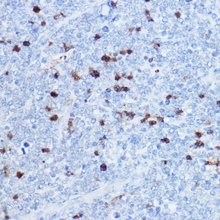 Immunohistochemistry - Anti-MRP8 Antibody (A16819) - Antibodies.com