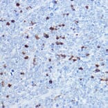 Immunohistochemistry - Anti-MRP8 Antibody (A16819) - Antibodies.com