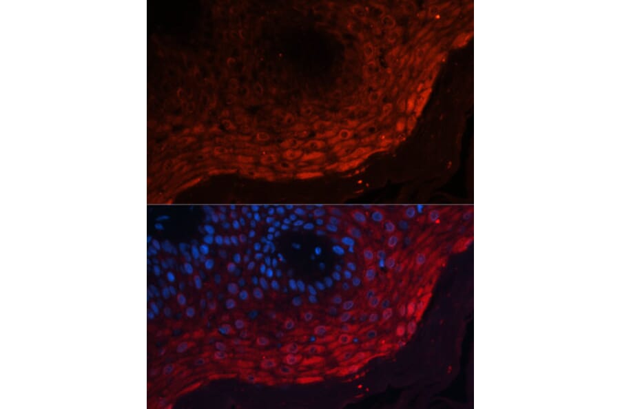Immunofluorescence - Anti-MRP8 Antibody (A16819) - Antibodies.com