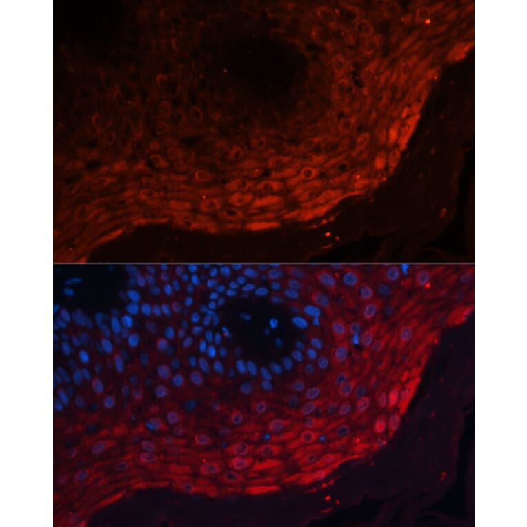 Immunofluorescence - Anti-MRP8 Antibody (A16819) - Antibodies.com