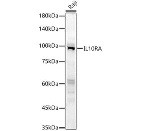 Western Blot - Anti-IL-10RA Antibody (A16820) - Antibodies.com