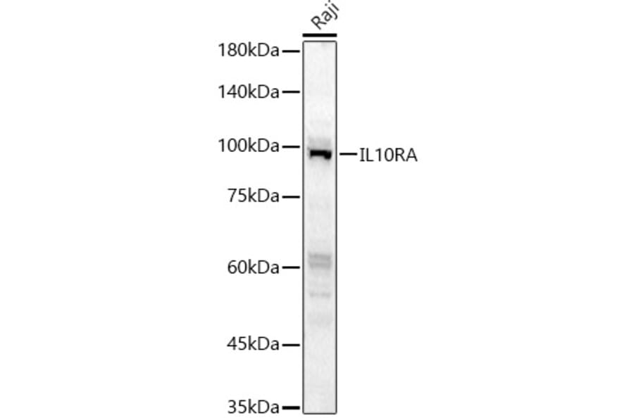 Western Blot - Anti-IL-10RA Antibody (A16820) - Antibodies.com