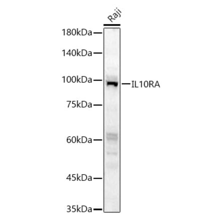 Western Blot - Anti-IL-10RA Antibody (A16820) - Antibodies.com