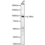 Western Blot - Anti-IL-10RA Antibody (A16820) - Antibodies.com