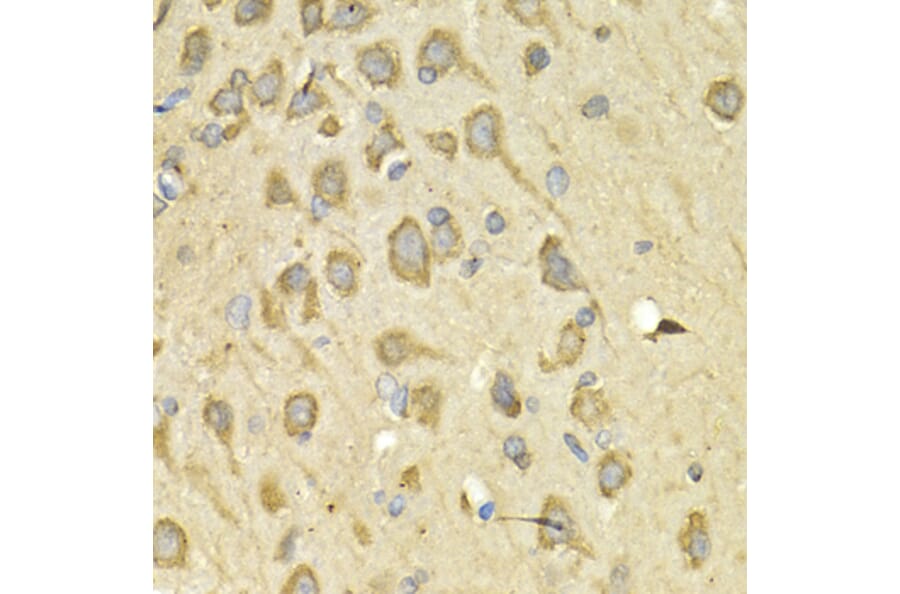 Immunohistochemistry - Anti-IL-10RA Antibody (A16820) - Antibodies.com