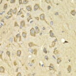 Immunohistochemistry - Anti-IL-10RA Antibody (A16820) - Antibodies.com