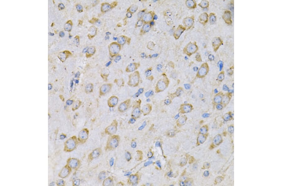 Immunohistochemistry - Anti-IL-10RA Antibody (A16820) - Antibodies.com