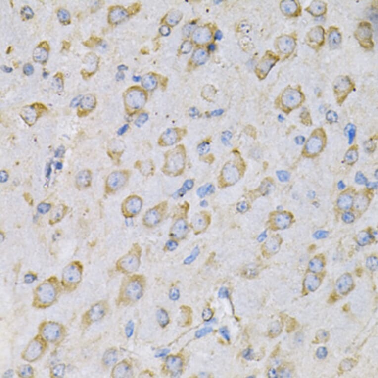 Immunohistochemistry - Anti-IL-10RA Antibody (A16820) - Antibodies.com