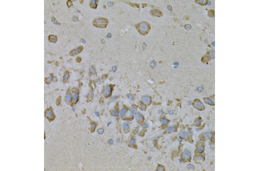 Immunohistochemistry - Anti-IL-10RA Antibody (A16820) - Antibodies.com
