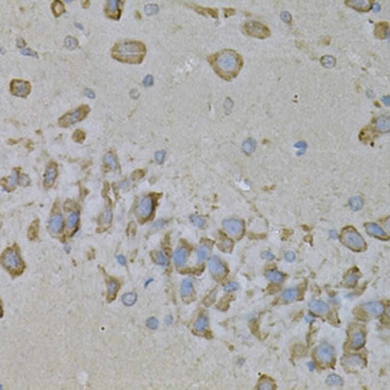 Immunohistochemistry - Anti-IL-10RA Antibody (A16820) - Antibodies.com