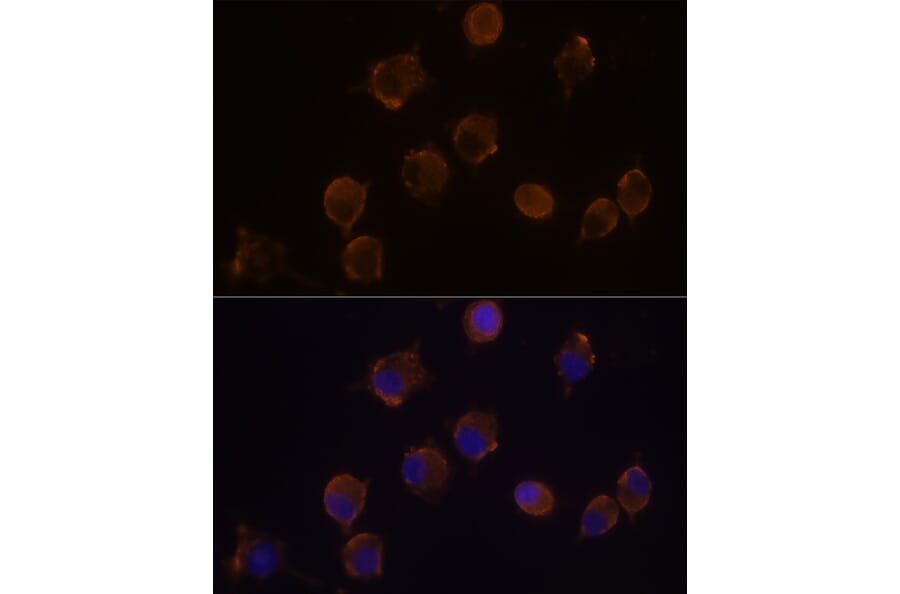 Immunofluorescence - Anti-IL-10RA Antibody (A16820) - Antibodies.com