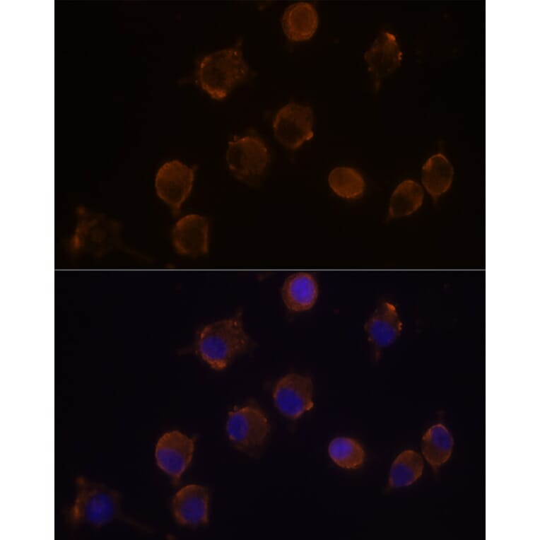 Immunofluorescence - Anti-IL-10RA Antibody (A16820) - Antibodies.com