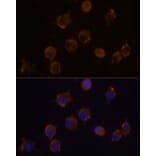 Immunofluorescence - Anti-IL-10RA Antibody (A16820) - Antibodies.com