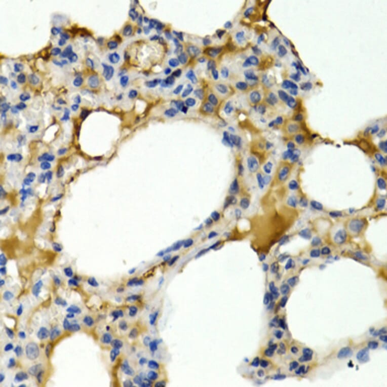 Immunohistochemistry - Anti-IL-9 Antibody (A16821) - Antibodies.com