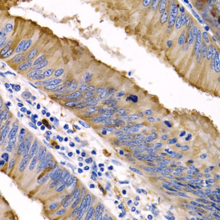 Immunohistochemistry - Anti-IL-9 Antibody (A16821) - Antibodies.com
