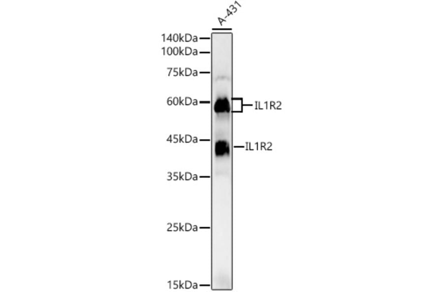 Western Blot - Anti-IL-1R-2 Antibody (A16822) - Antibodies.com