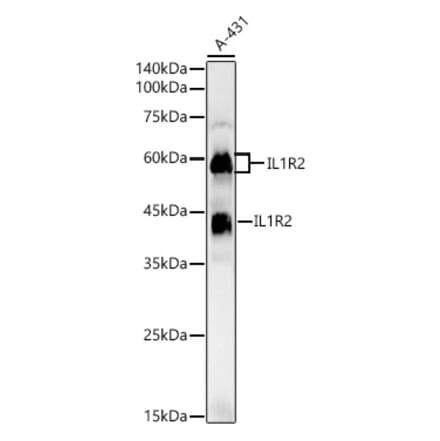 Western Blot - Anti-IL-1R-2 Antibody (A16822) - Antibodies.com