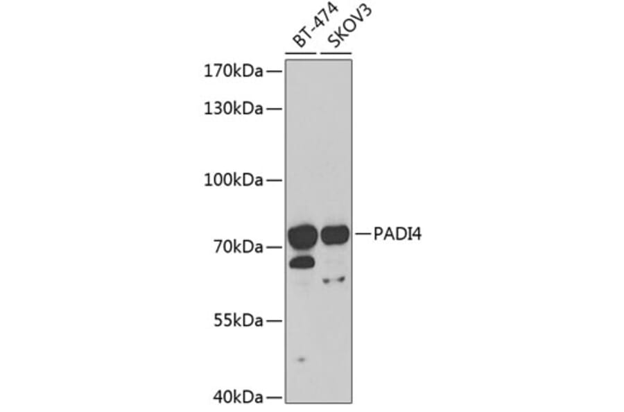 Western Blot - Anti-PADI4 / PAD4 Antibody (A16823) - Antibodies.com