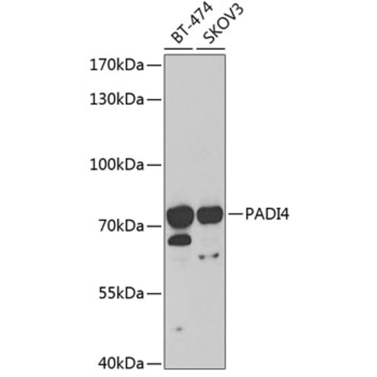 Western Blot - Anti-PADI4 / PAD4 Antibody (A16823) - Antibodies.com