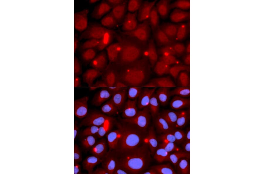 Immunofluorescence - Anti-PADI4 / PAD4 Antibody (A16823) - Antibodies.com