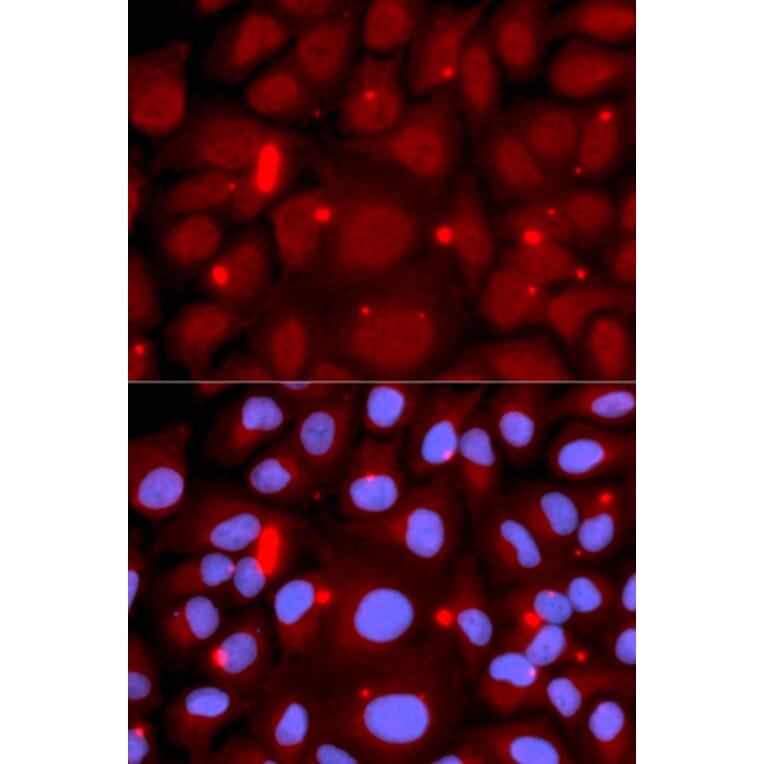 Immunofluorescence - Anti-PADI4 / PAD4 Antibody (A16823) - Antibodies.com