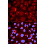 Immunofluorescence - Anti-PADI4 / PAD4 Antibody (A16823) - Antibodies.com