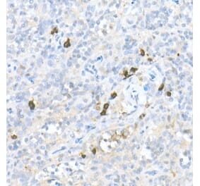 Immunohistochemistry - Anti-MDC Antibody (A16824) - Antibodies.com