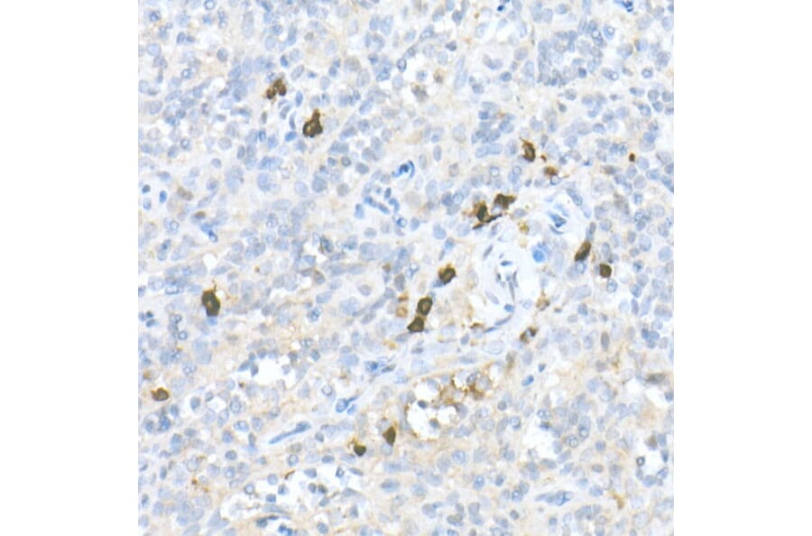 Immunohistochemistry - Anti-MDC Antibody (A16824) - Antibodies.com