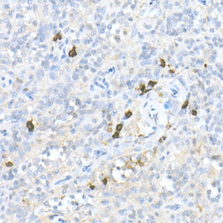Immunohistochemistry - Anti-MDC Antibody (A16824) - Antibodies.com