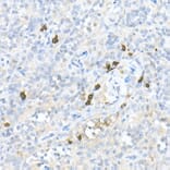 Immunohistochemistry - Anti-MDC Antibody (A16824) - Antibodies.com
