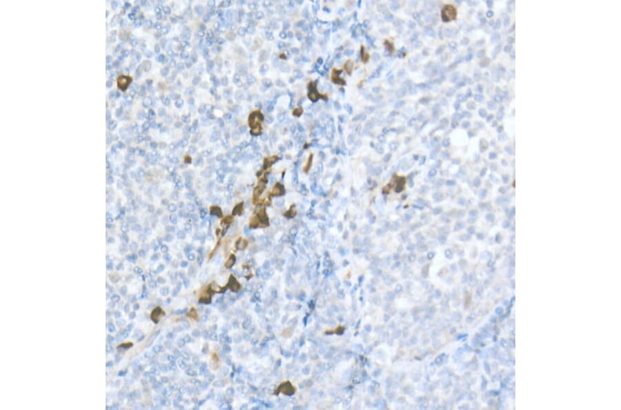 Immunohistochemistry - Anti-MDC Antibody (A16824) - Antibodies.com